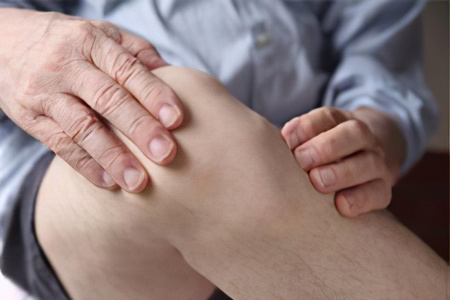 Симптомы артрита коленного сустава