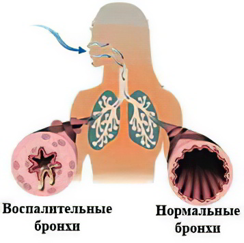 какая диета при больной печени