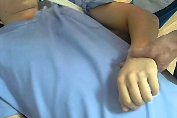 диагностика атрофии мышц руки