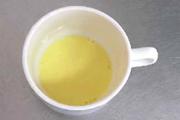 Лечение трофических язв маслом
