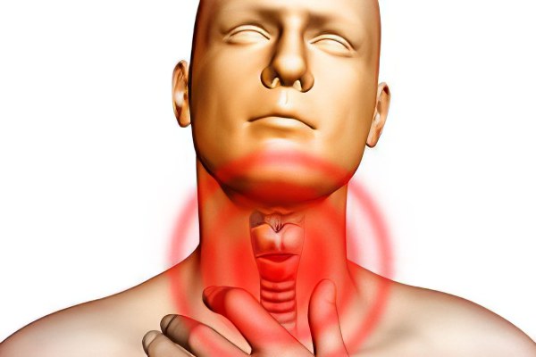 Причины грибка в горле