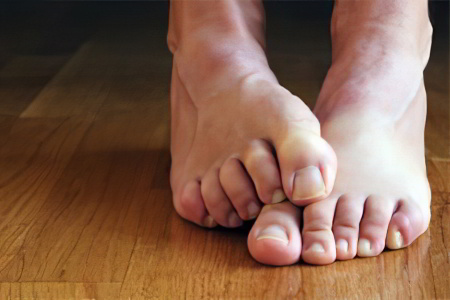 Причины появления грибка ногтей на ногах