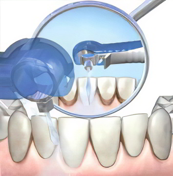 Меры профилактики зубов