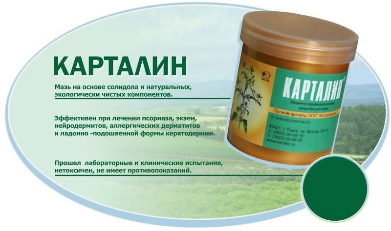 Ванны с чистотелом при псориазе