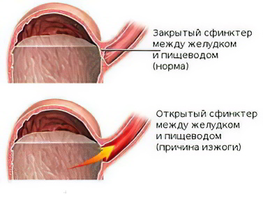 методы очищения организма с помощью диеты в домашних условиях