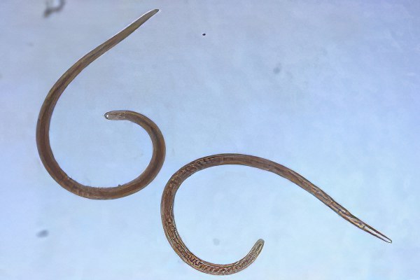 Лечение глистов – схема лечения глистов у взрослых и детей