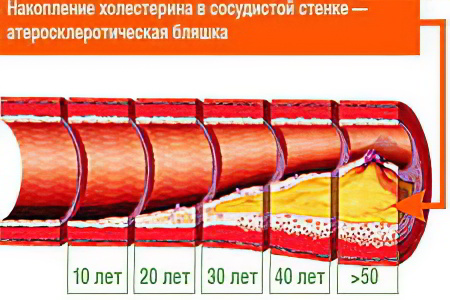 сколько норма холестерина в крови у человека сколько норма холестерина в крови у человека