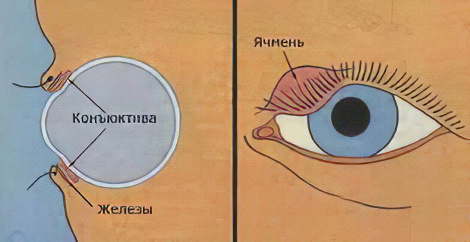 как похудеть на 14 кг за 14 дней