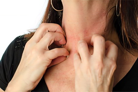 Аллергическое раздражение кожи