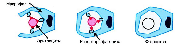 Гемолитическая анемия