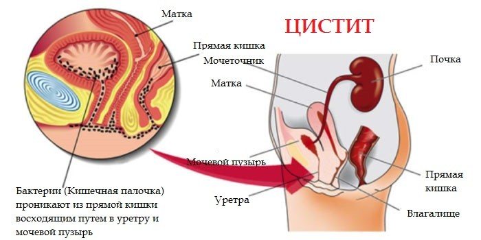 Постоянно ноющая тянущая боль в низу живота