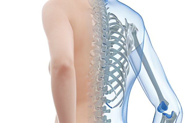 Что такое остеопороз и как его вылечить thumbnail