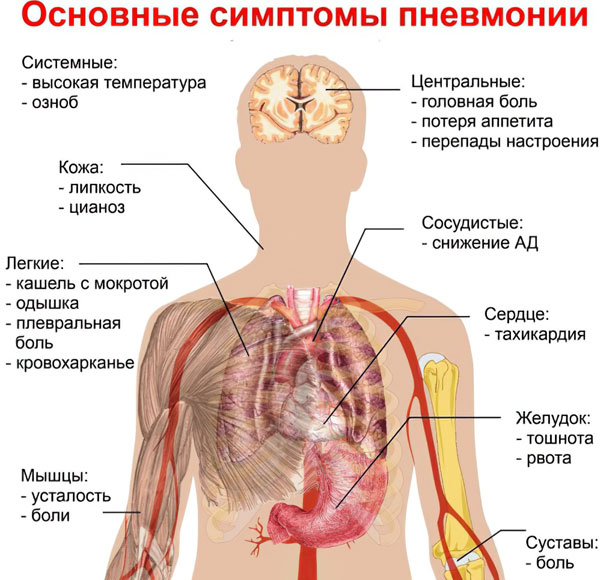 первые признаки начинающейся пневмонии