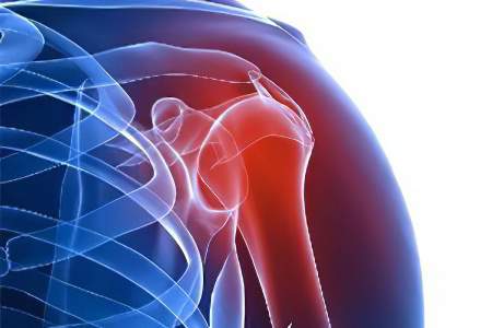 Почему болят плечевые суставы