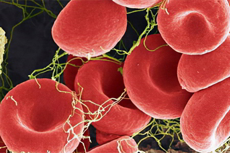 Что такое анемия и опасна ли она thumbnail
