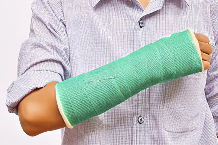 Реабилитация после переломов руки
