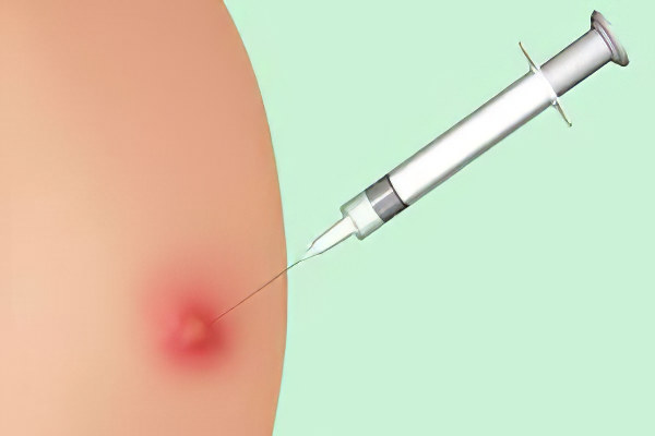 Направление на прививку от дифтерии thumbnail