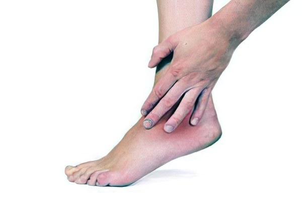 Симптомы, сопровождающие отек голеностопного и коленного сустава