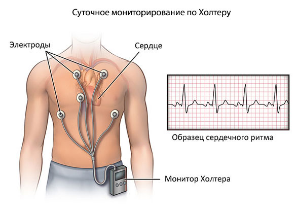 Диагностика учащенного сердцебиения