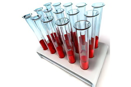 Биохимический анализ крови алт нормы таблица thumbnail