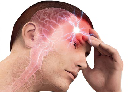 Что такое головная боль и как с ней бороться thumbnail