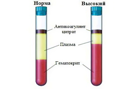 Норма гематокрита в крови в процентах thumbnail