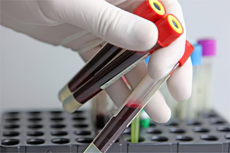 Что показывает биохимический анализ крови: расшифровка, норма