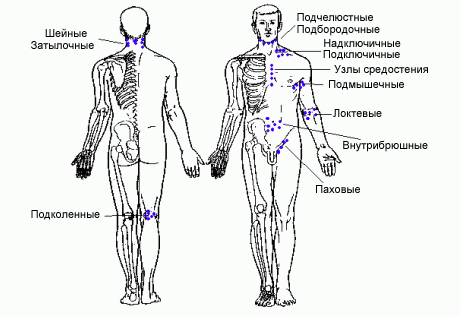 Лимфатический узел