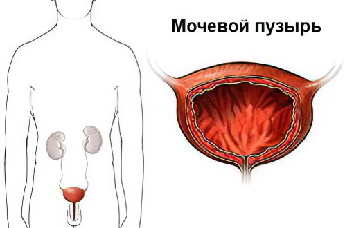 Мочевой пузырь