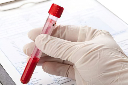 Что показывает биохимический анализ крови: расшифровка, норма