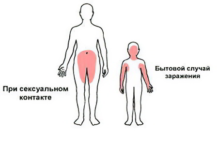 Как происходит заражение