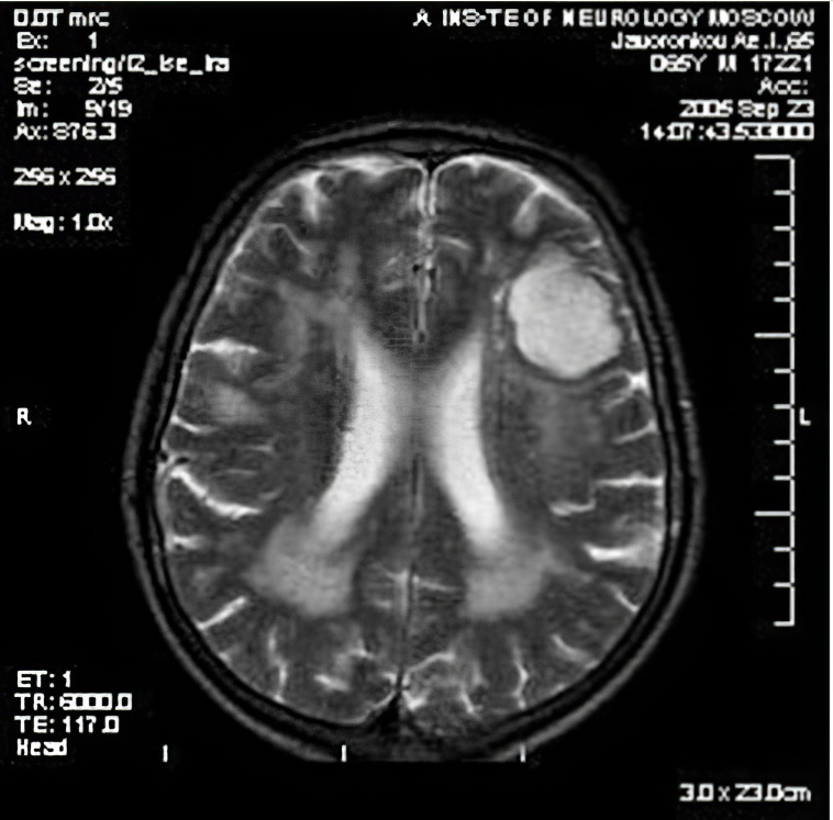 Виды болезней нервной системы и их лечение thumbnail