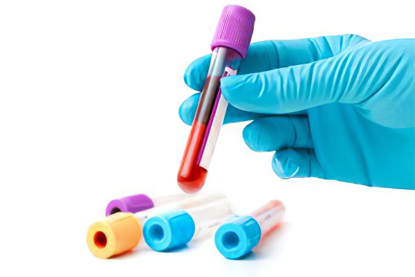 Общий анализ крови расшифровка оседание эритроцитов thumbnail