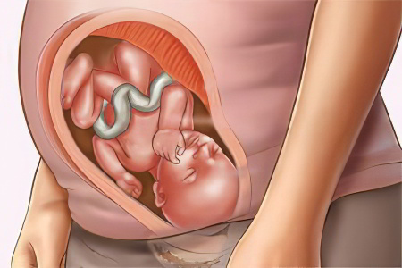 От чего болит поясница на 9 месяце беременности thumbnail