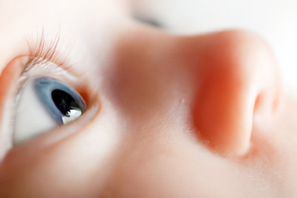атрофия зрительного нерва у детей
