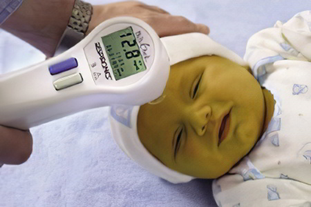 Повышенный билирубин у новорождённых