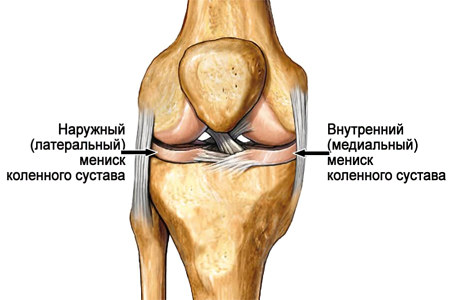 Что такое мениск коленного сустава