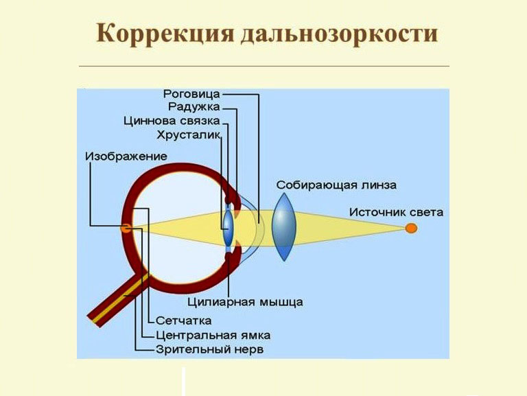 Оптическая коррекция зрения Оптическая коррекция зрения