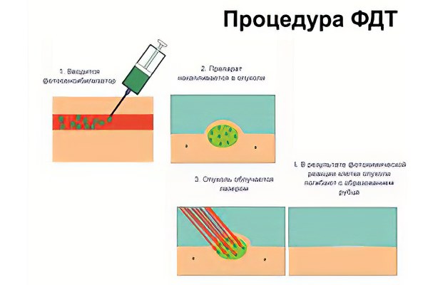 Этапы проведения