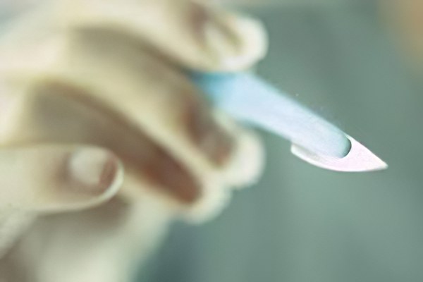 Хирургическое лечение Хирургическое лечение