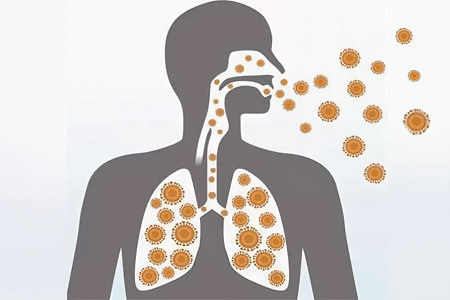 Все о инфекциях верхних дыхательных путей