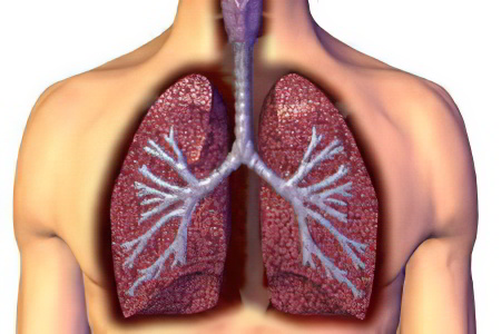 Инфильтративный туберкулёз лёгких