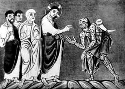 история проказы история проказы