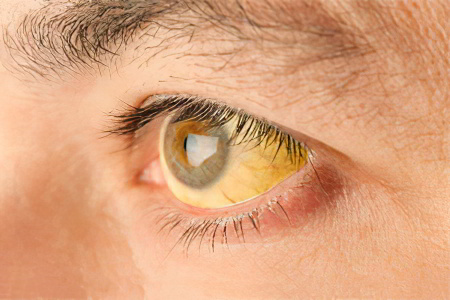 Желтые глаза