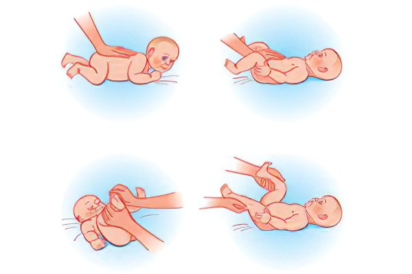 Изображение - Дисплазия тазобедренного сустава у ребенка 1 год klassifikaciya-displazii46
