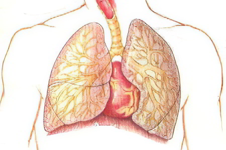 Классификация абсцессов лёгких