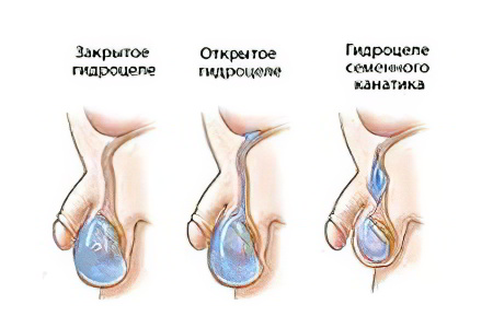 Классификация