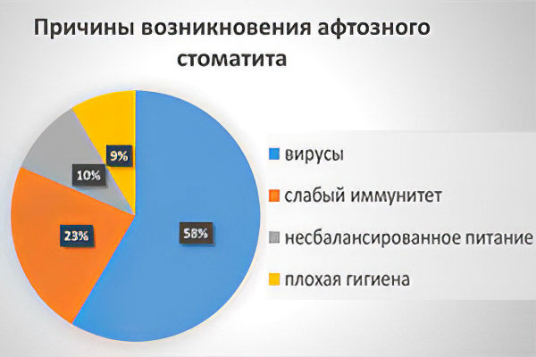 Причины афтозного стоматита