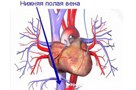 Клиническая картина