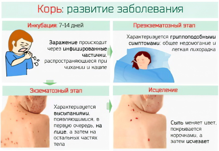 Корь Корь